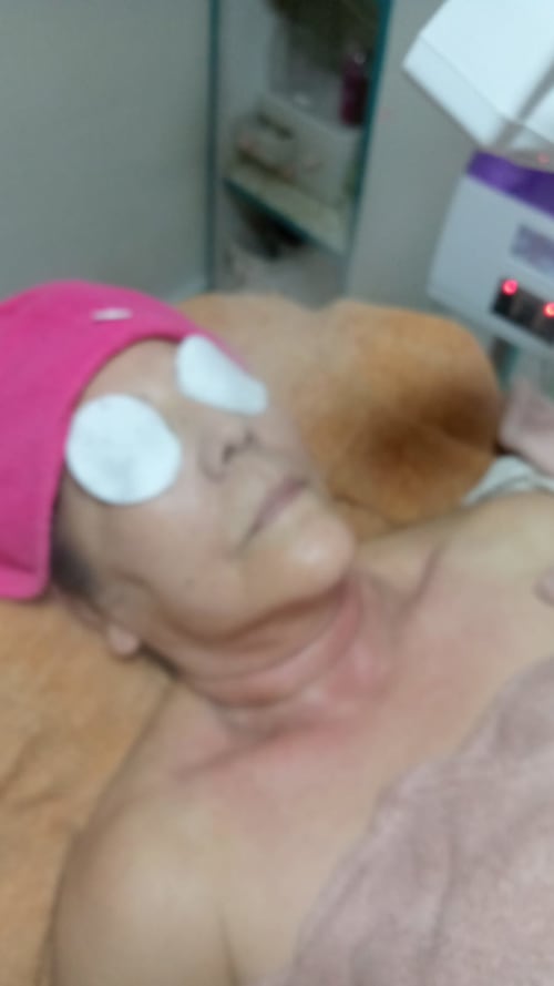 Limpieza facial profunda #3