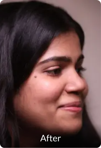 Korean Facial Illumination