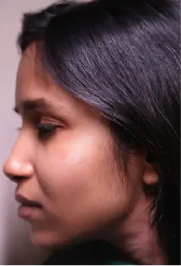 Elastin Boost Facial