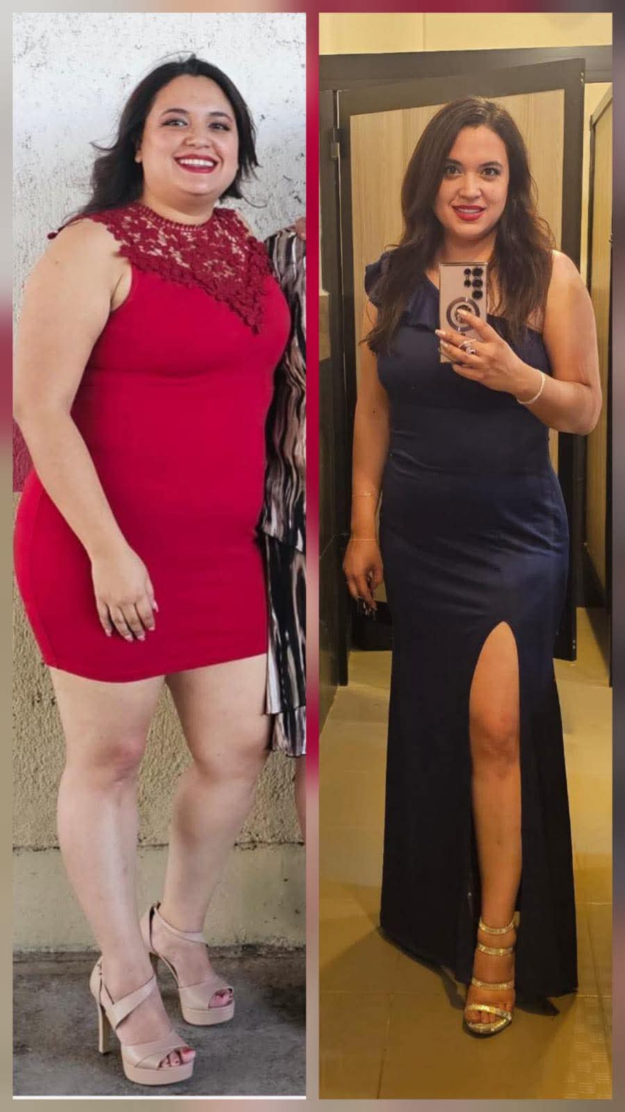 Zona de rehabilitación