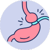 Bariatric Surgery