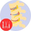 Spinal Surgery