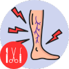 Vascular Surgery {Arteries and Vein Surgery}