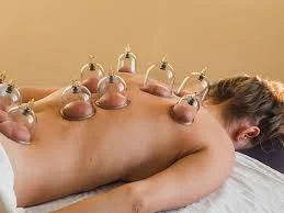 Séance de Hijama (sèche ou humide) au Centre Bayane de Rabat