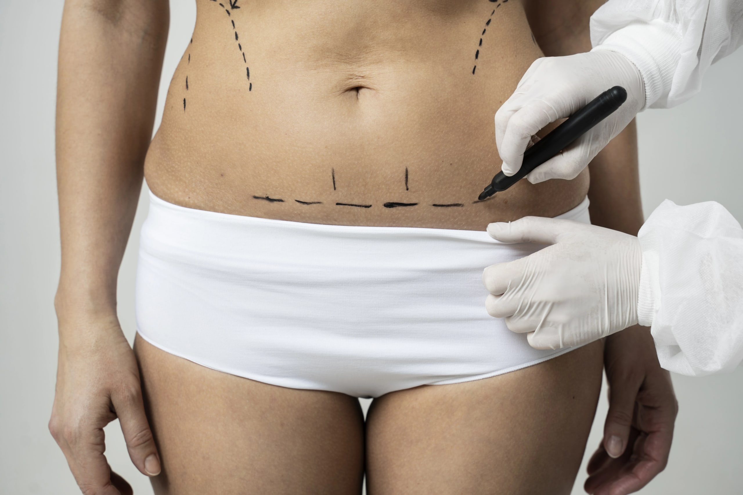 Erro médico em procedimento estético: quando cabe indenização e como provar