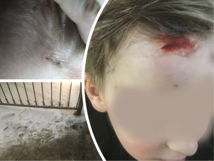 В Ярославле поскользнувшийся школьник упал лицом на забор