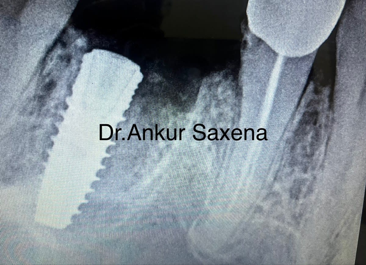 Noida Dental Hospital photo 4