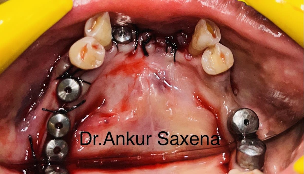 Noida Dental Hospital photo 5