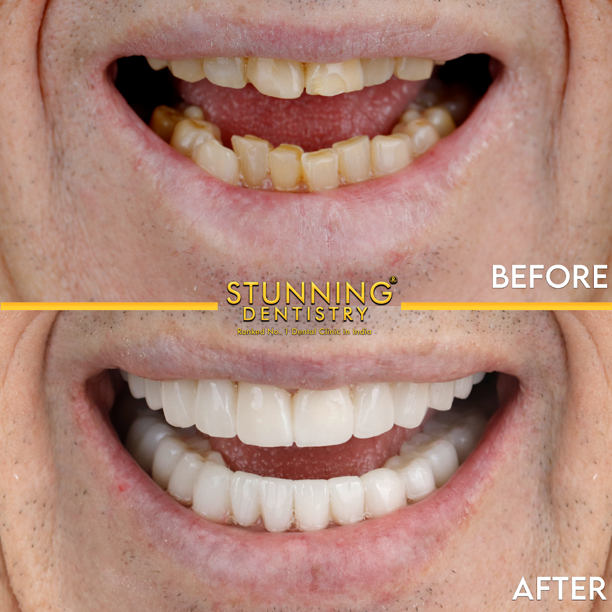 Stunning Dentistry thumbnail 2