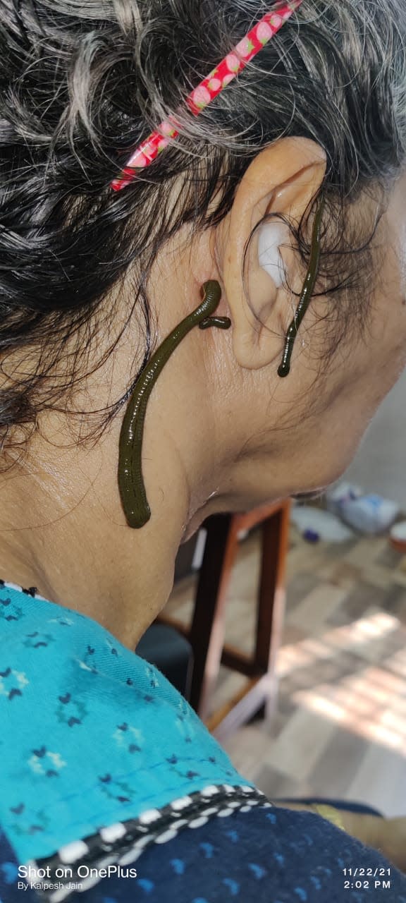 Shanti Ayurveda/Best Ayurvedic Fertility, Panchkarma & kshar-Sutra Clinic thumbnail 3