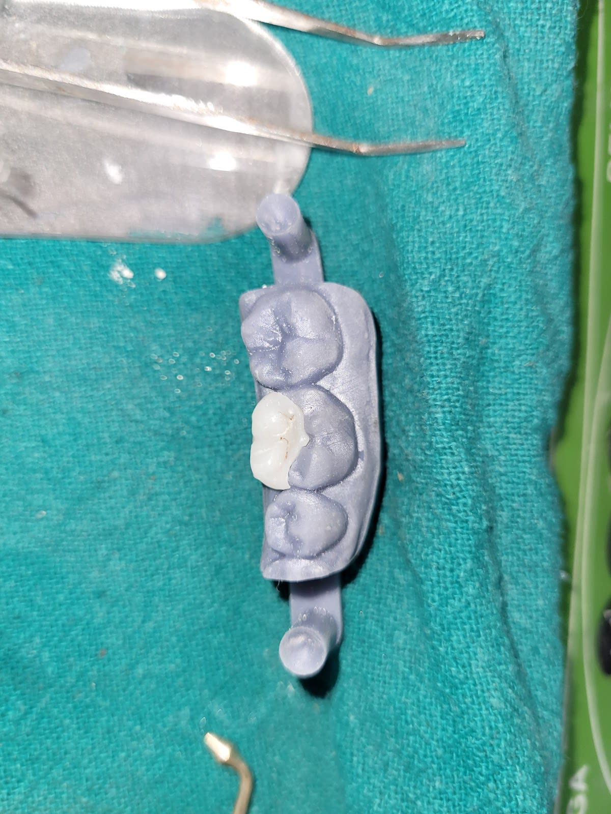 Center Of Dental Treatment (RCT, Implants, Zirconia Crowns ,Smile Designing, Wisdom Tooth Extractions) 20 Years Of Experience photo 5