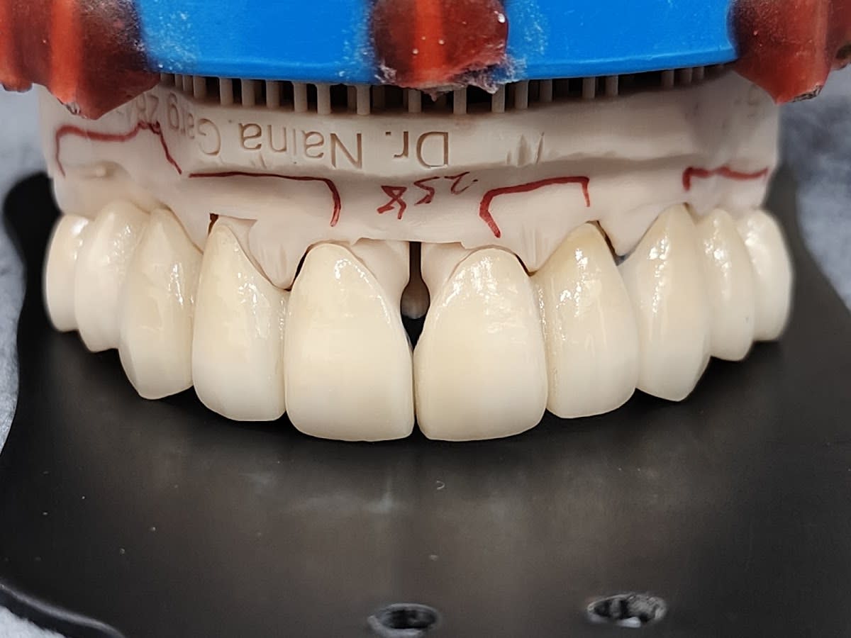 Dr Naina's Smileline Dental Clinic thumbnail 2