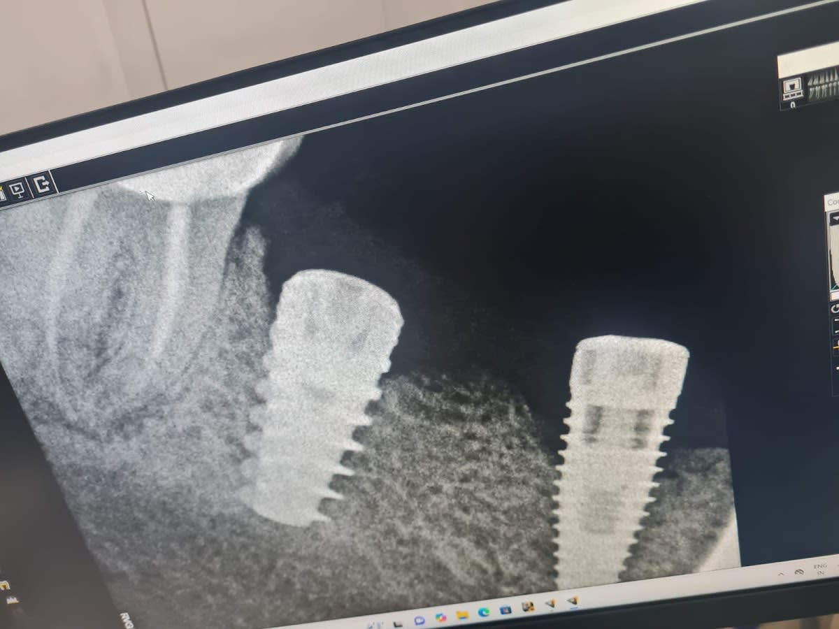 Caps N Crown Dental Clinic photo 4