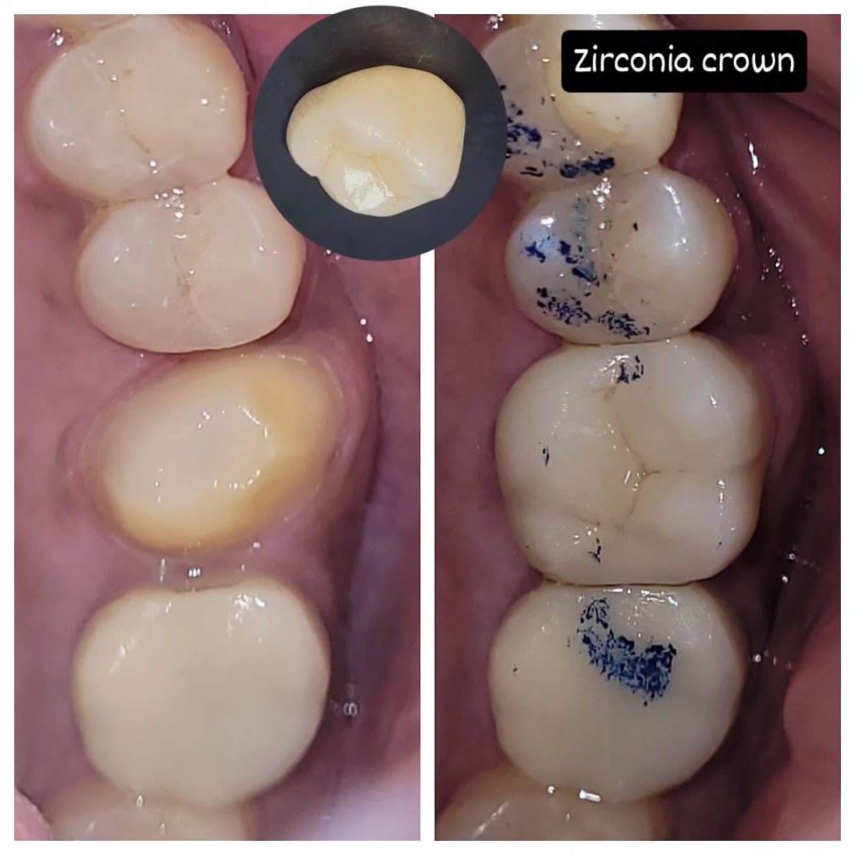 Kaizen Dental photo 5