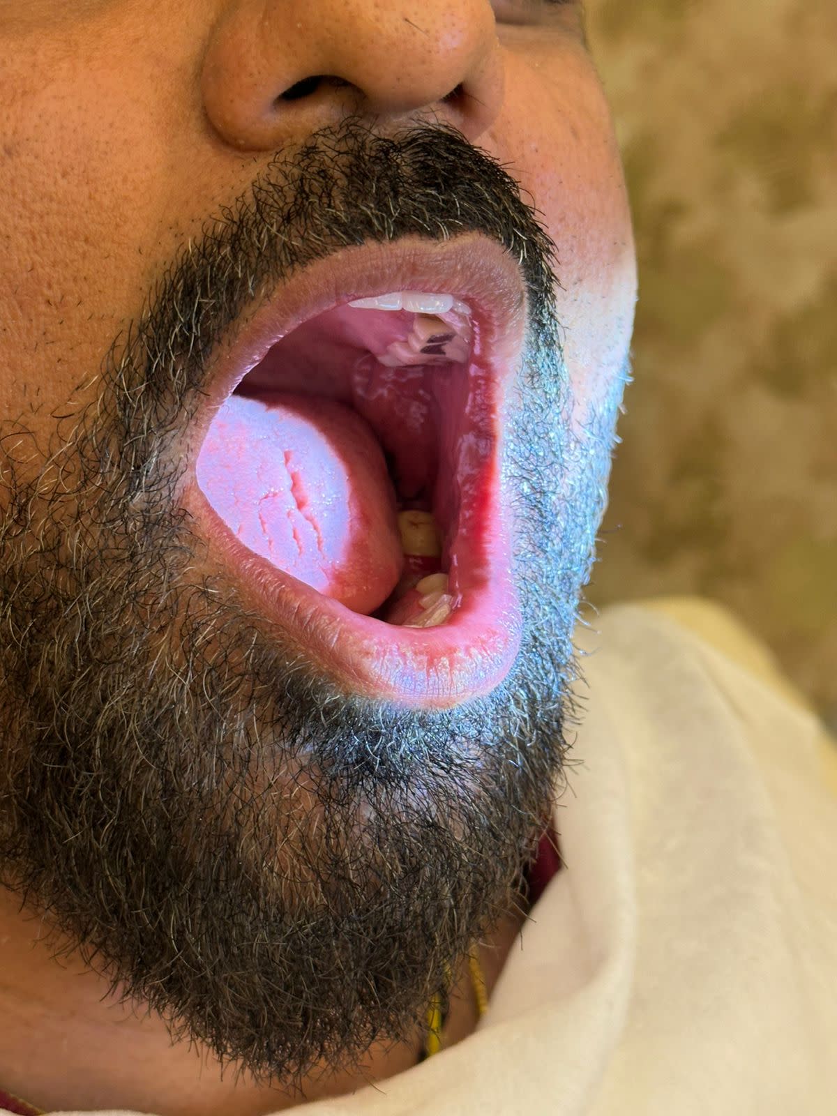 Dr. Kasana Dental Clinic For Dental Implant & Smile Design photo 4
