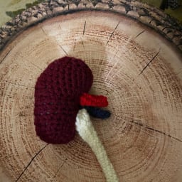 The Kidney Twins (Anatomical Pair) - Thumbnail 1