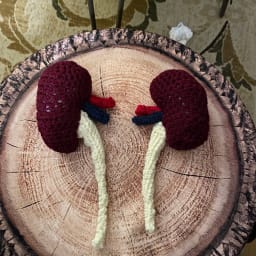 The Kidney Twins (Anatomical Pair) - Thumbnail 2