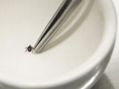 В Тюменской области выявлено два случая клещевого энцефалита