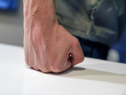 Тюменец получил перелом носа и челюсти из-за соседской собаки