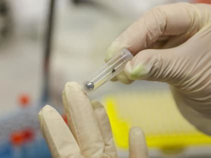 В Тюменской области пострадавший от укуса клеща скончался от энцефалита