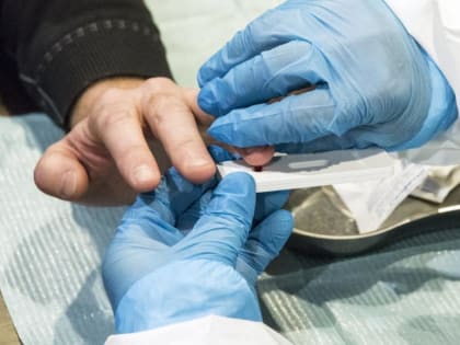 Тремор рук: когда дрожание становится тревожным сигналом