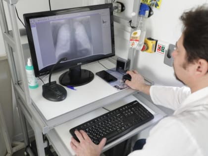 80% случаев рака легких приходится на курильщиков с внушительным стажем