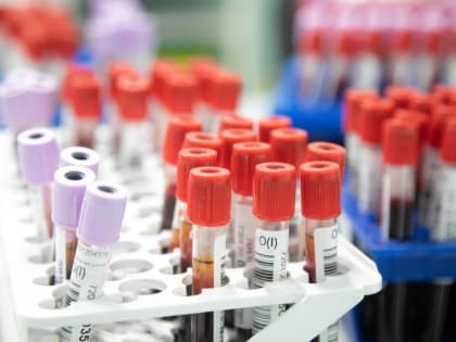 Новый штамм COVID-19 ХЕС быстро распространяется в России