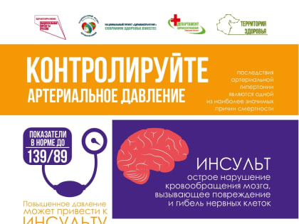 Как действовать при инсульте: советы первой помощи