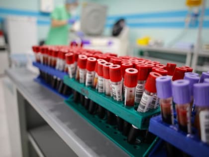 Темп прироста ВИЧ в Тюменской области снизился на 5%