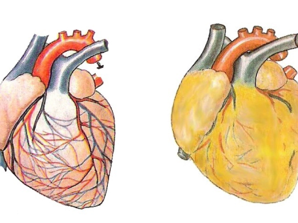 Алкоголь и сердце