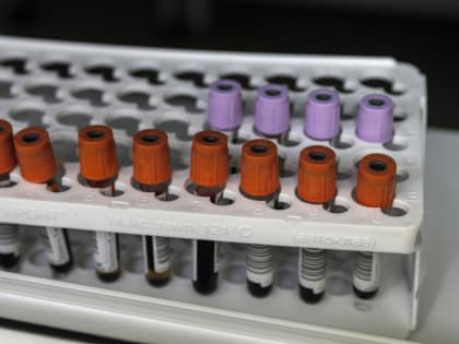 В городских пространствах Тюмени можно бесплатно пройти экспресс-тестирование на ВИЧ-инфекцию