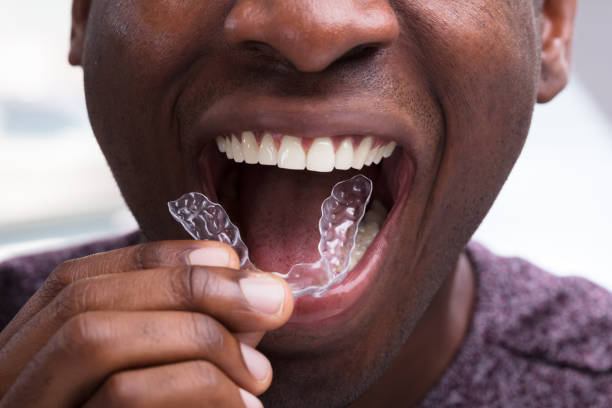Invisalign