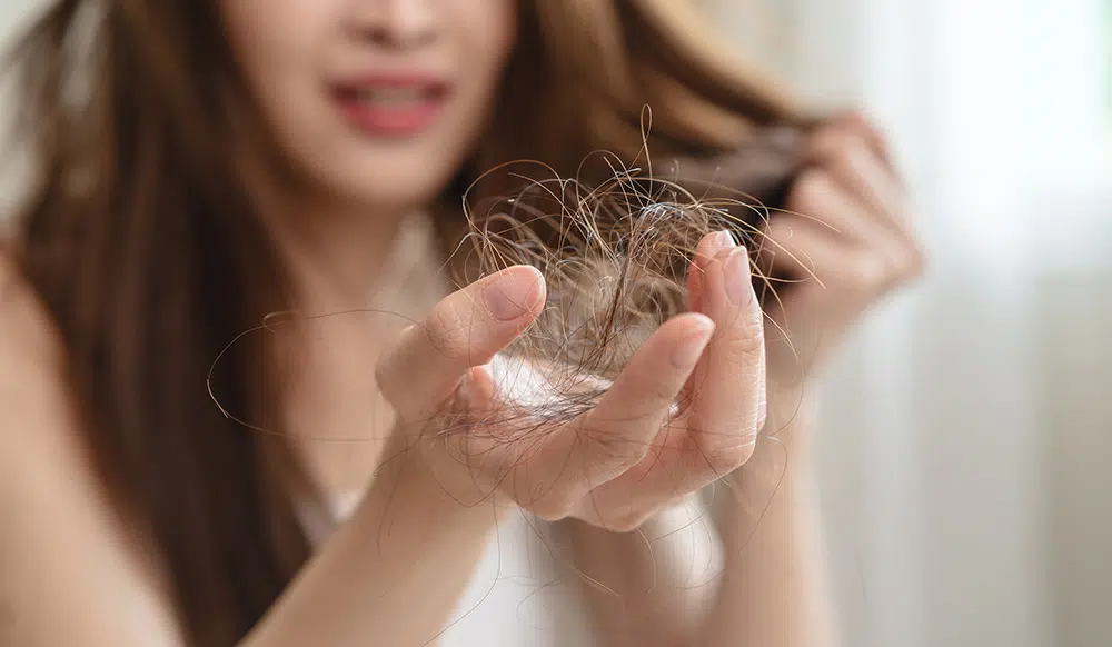 Hair Fall & Hair Growth