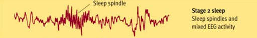 Stage 2 Brain Waves