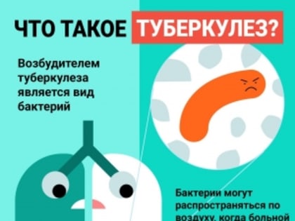 Более 15 тысяч первоуральцев в этом году прошли флюорографию