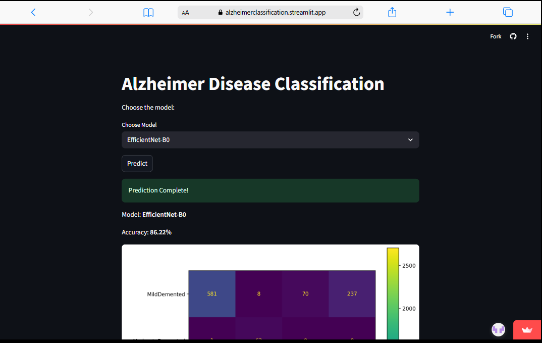 Alzheimer’s Disease Classification Website project preview