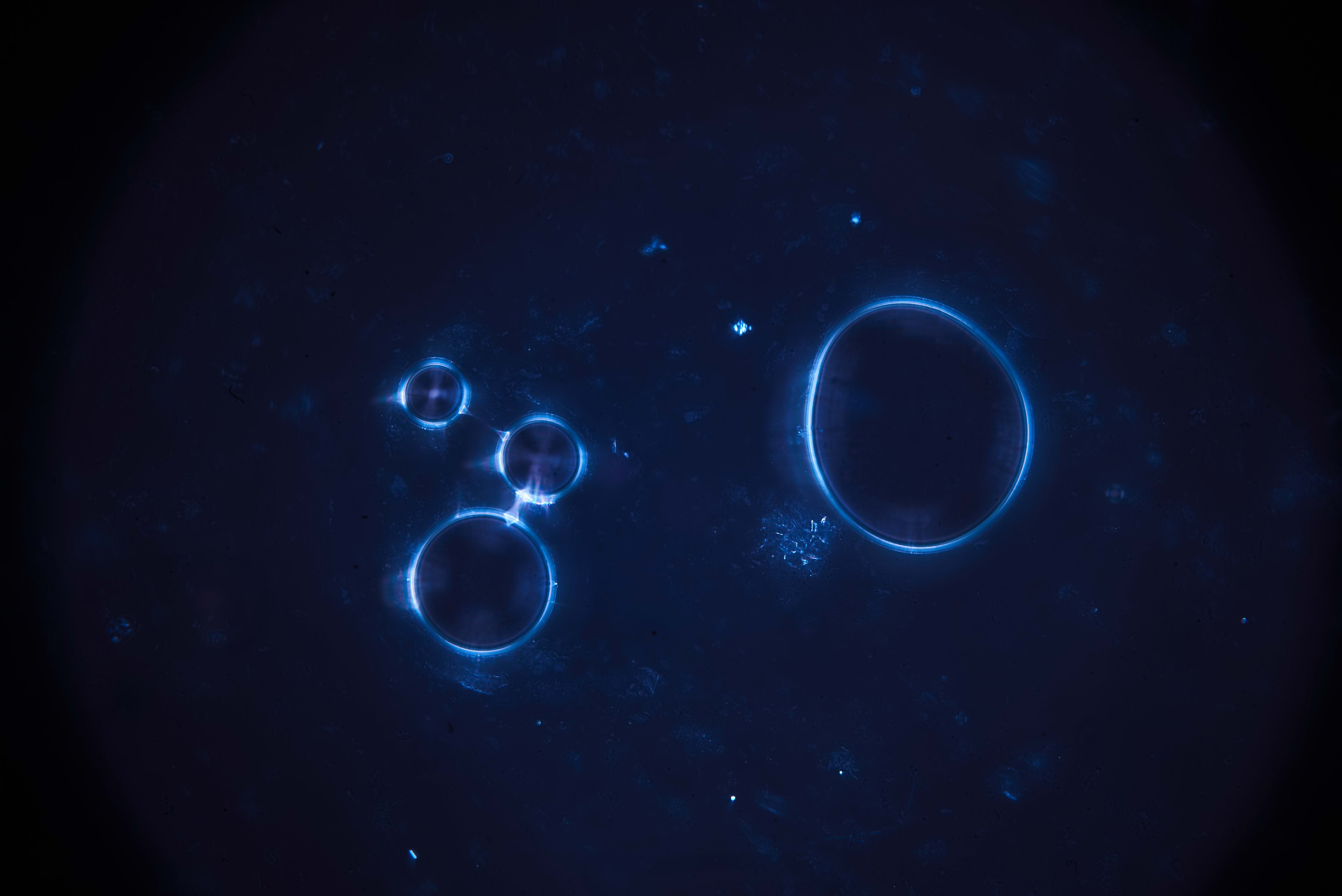 Blue spherical structures sit against a dark, textured field in a microscope image.