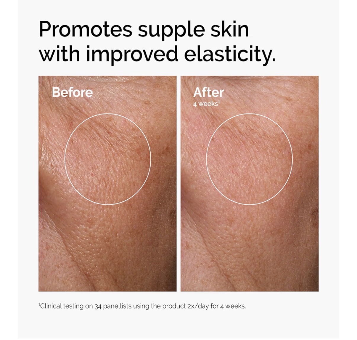 The ordinary serum ácido hialuronico