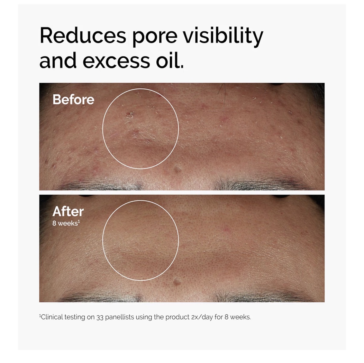 The ordinary serum niacinamida