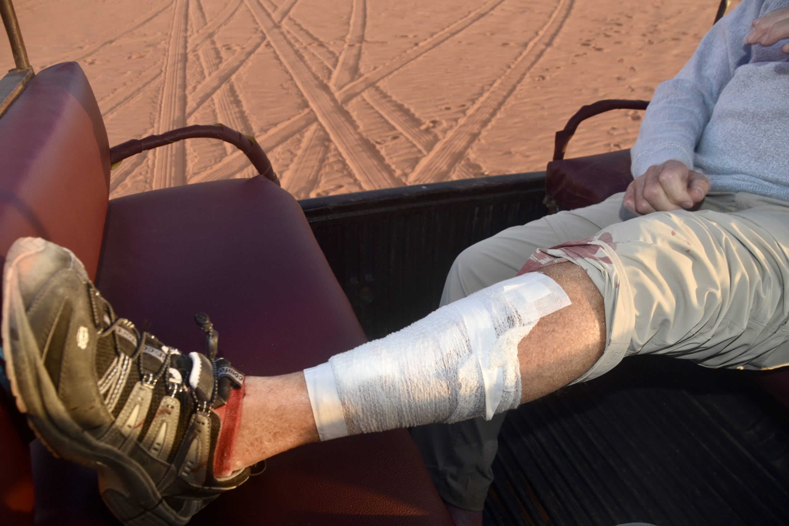 John's well-skinned leg