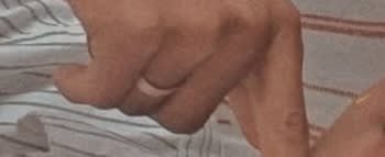 Lost Item Image