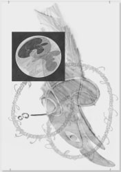 Josse Pyl, Rubbing Teeth Till Words Appear V