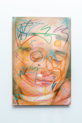 Stijn Elshuis, Scar tissue