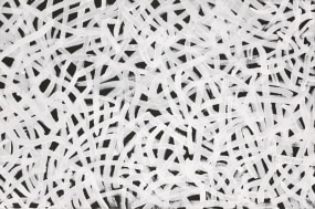 Emily Kame Kngwarreye, Yam Dreaming