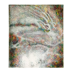 Lode Laperre, Ennertia (Pigment_Dispersion_Syndrome)