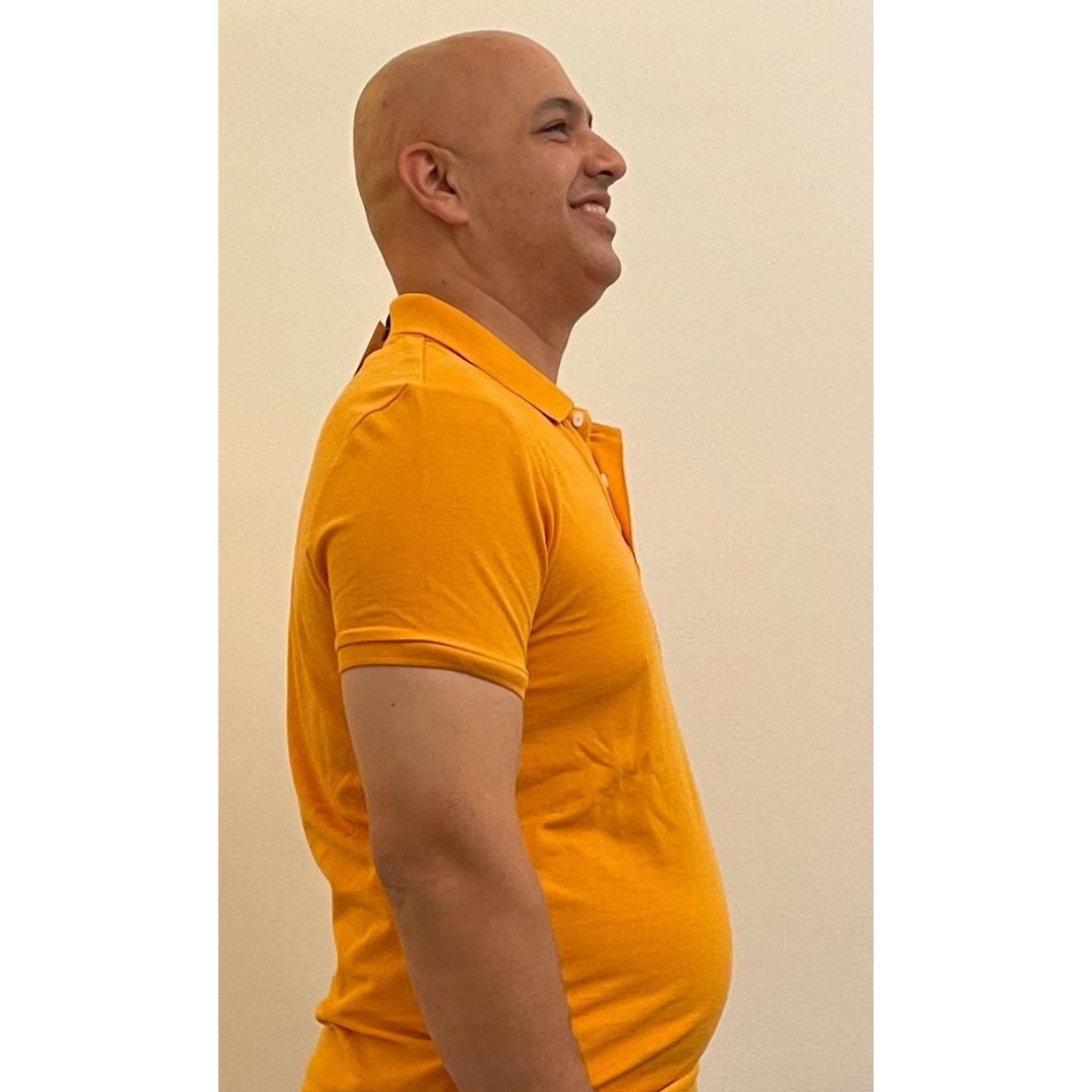 Before photo of Reza