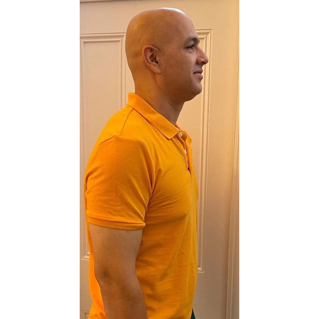 After photo of Reza