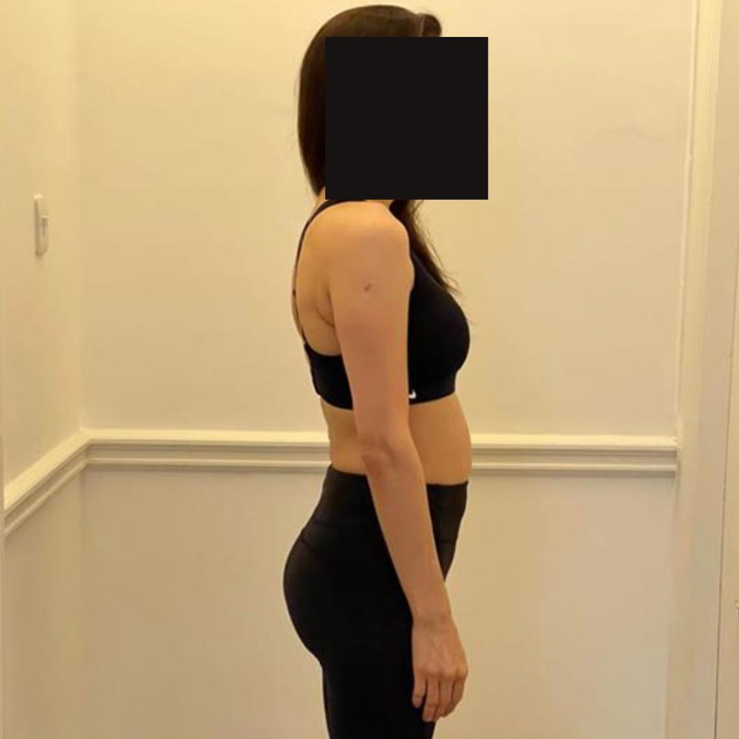 Before photo of Parisa