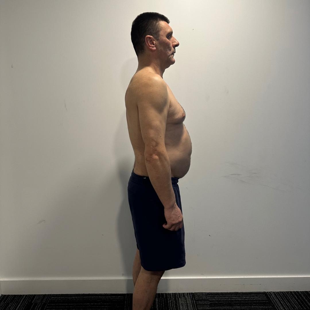 Before photo of Zarko