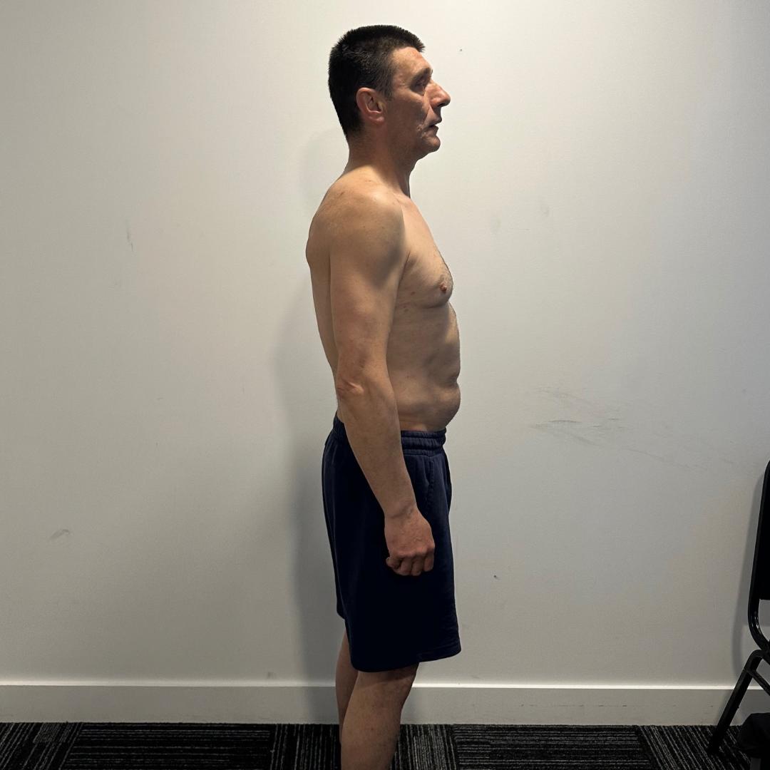 After photo of Zarko